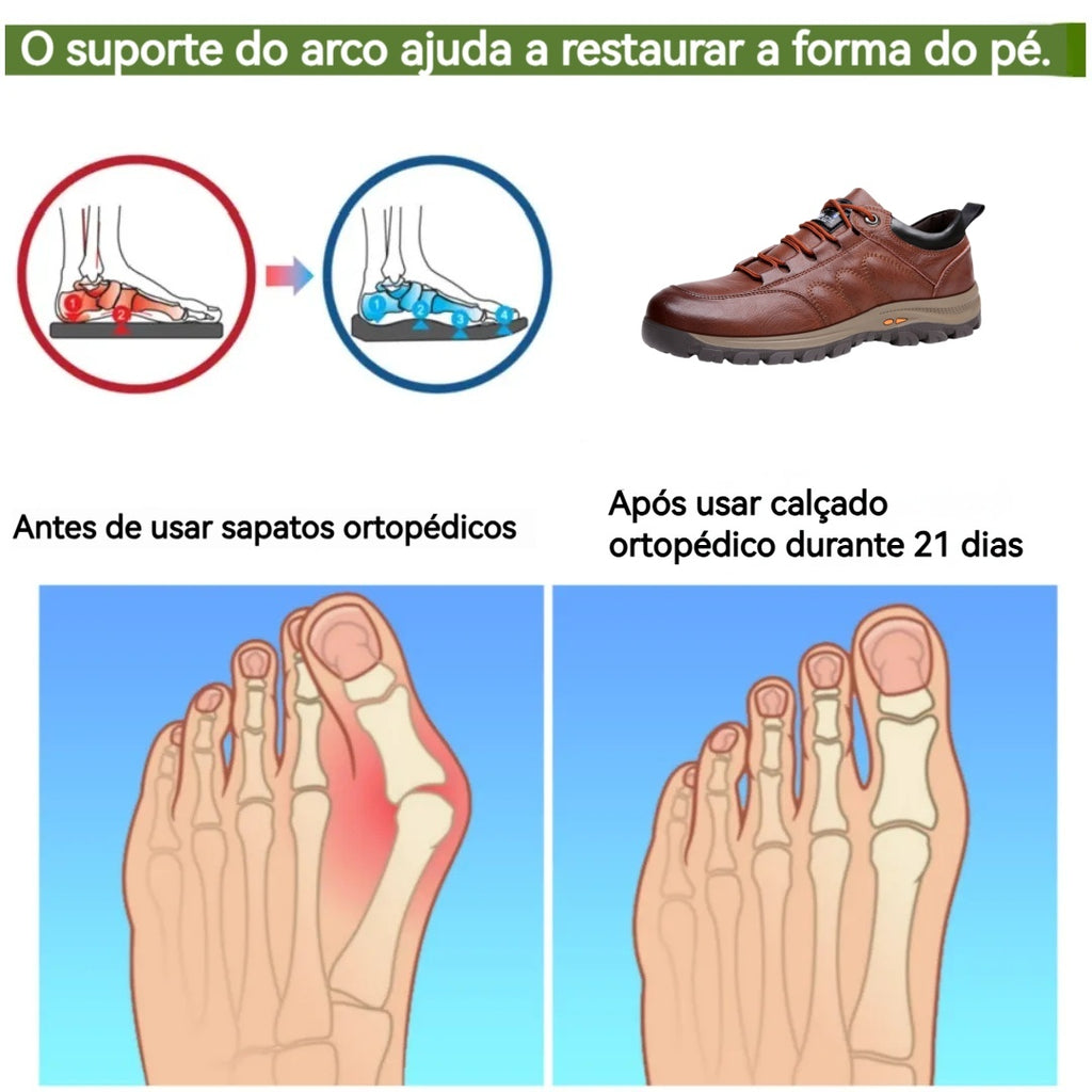 🔥Oferta por tempo limitado hoje: 70 % popust!  ⏰ - Sapatos ortopédicos com design ergonómico - Couro premium + costura manual 👞