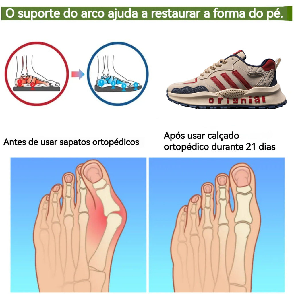 🔥Oferta por tempo limitado de hoje: 30% de desconto⏰ - Calçado ortopédico ZAPIEERS® | Conforto para caminhar o dia todo