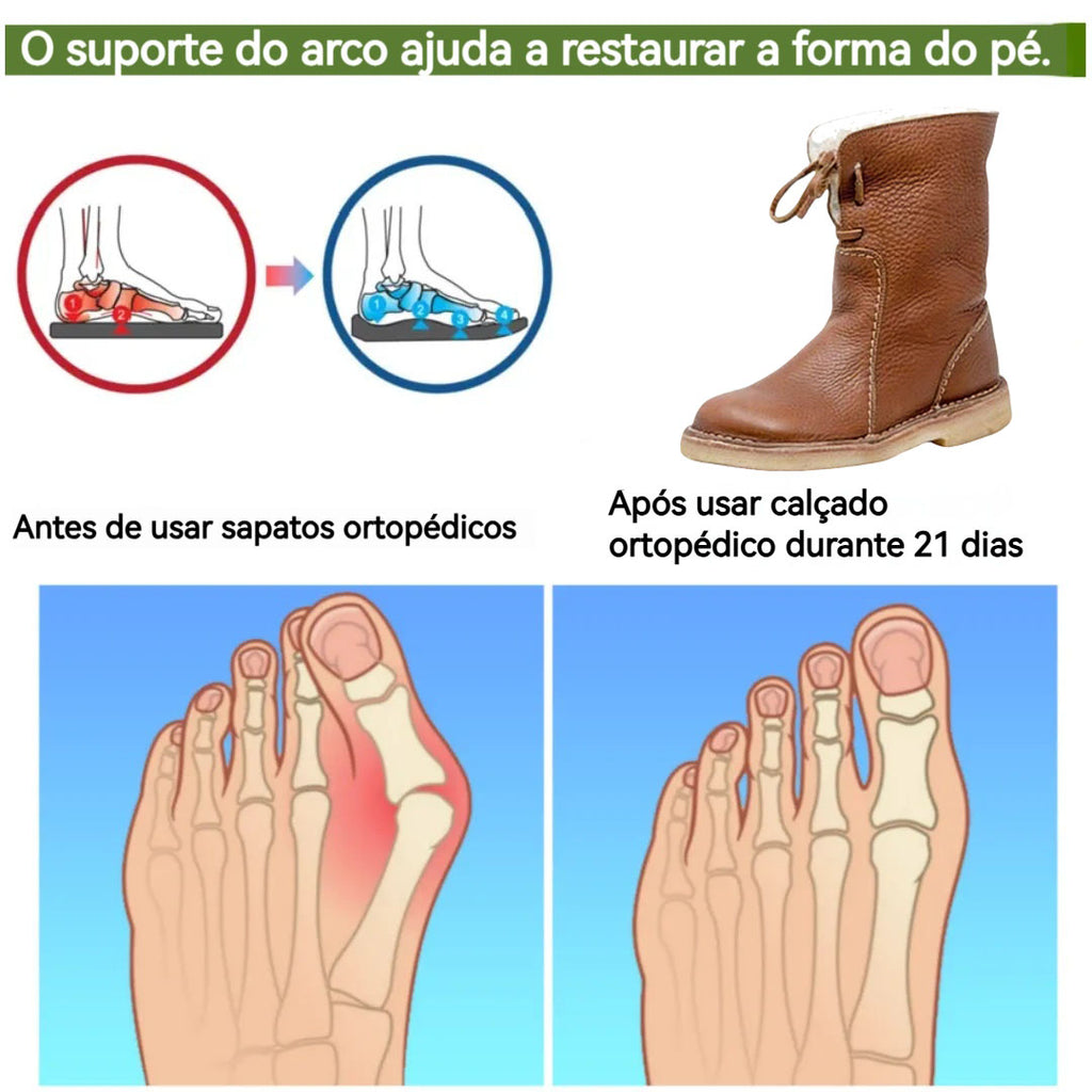🔥Oferta por tempo limitado: 30% de desconto hoje! ⏰ - Sapatos Ortopédicos ZAPIEERS® | Couro Premium 👞Costurado à mão