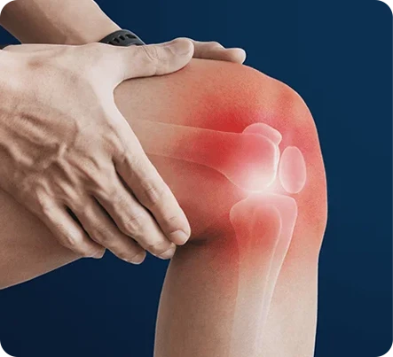 Desgaste de rodilla:
