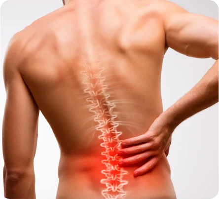 Compresión de la columna lumbar: