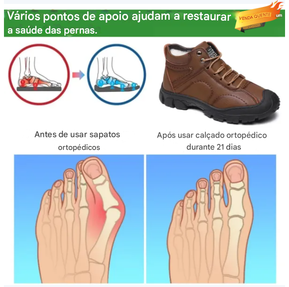 🔥Oferta por tempo limitado hoje: 70 % popust!  ⏰  - Calçado casual ZAPIEERS®, - Sapatos ortopédicos com design ergonómico - Couro premium + costura manual 👞